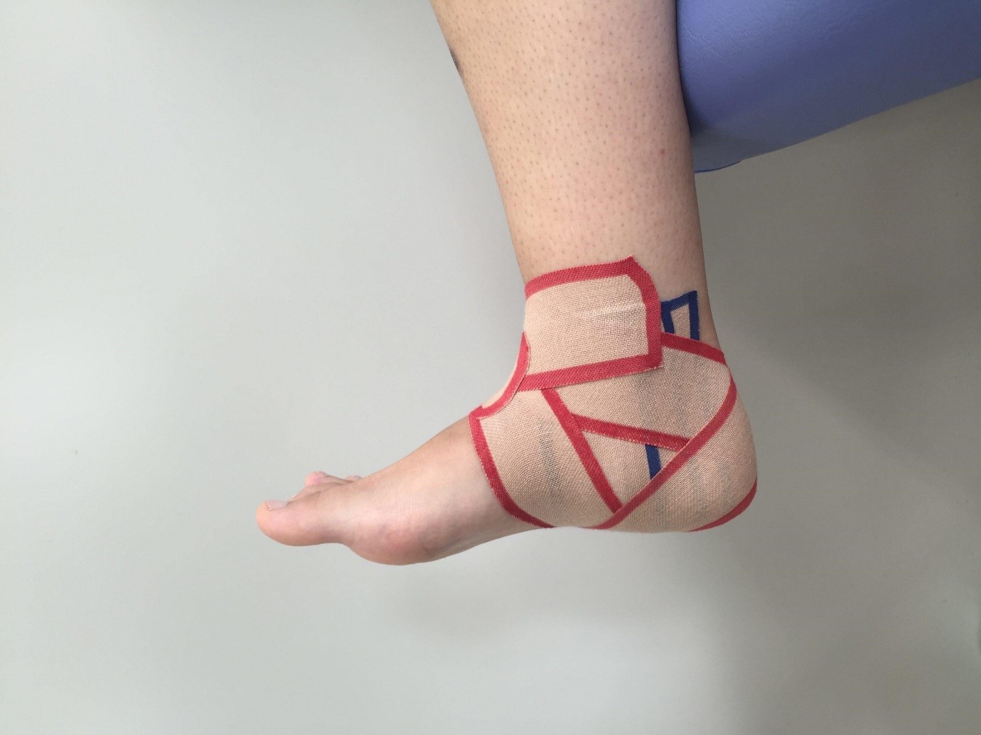 Kinesio Tape